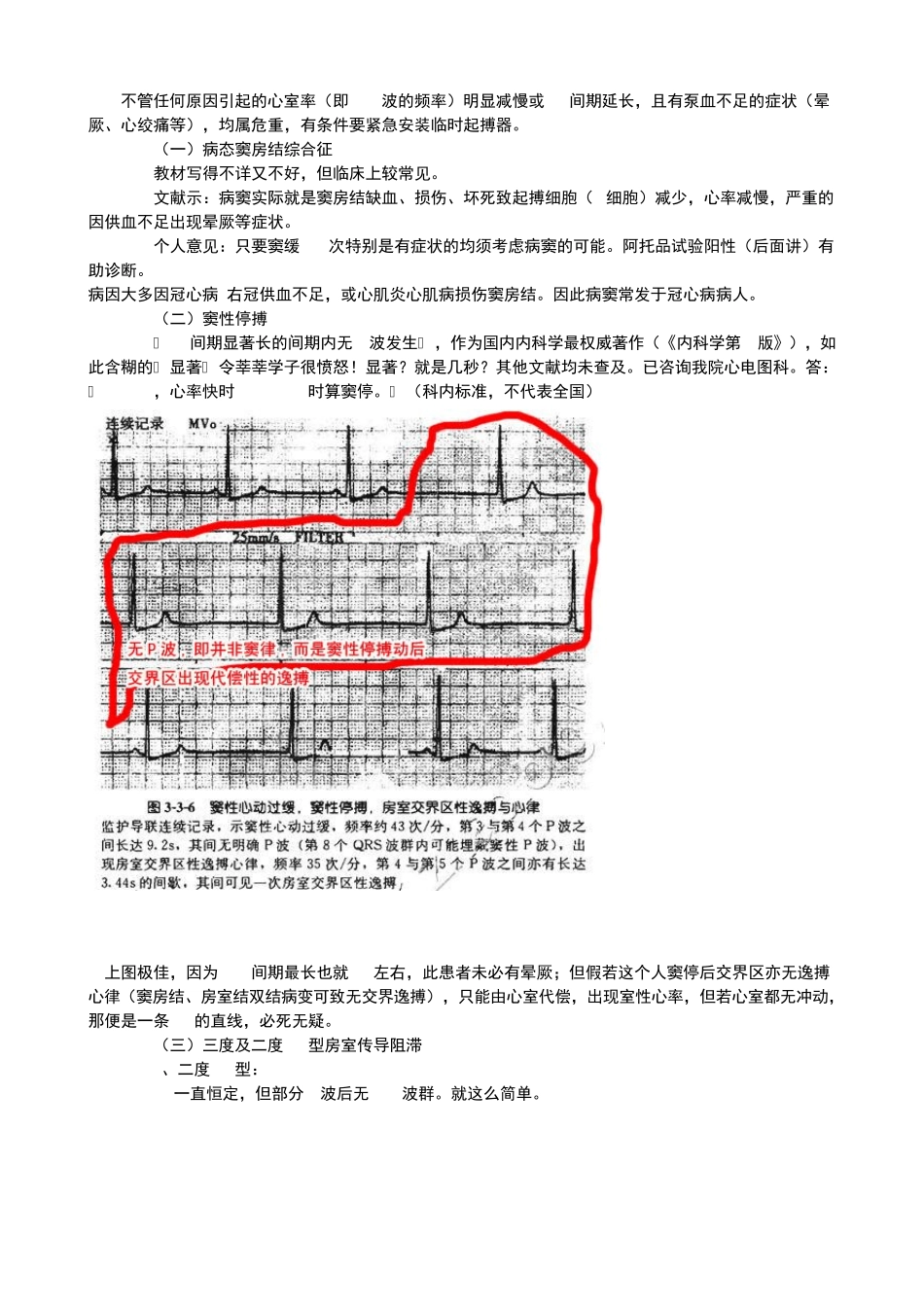 房室传导阻滞治疗_第1页