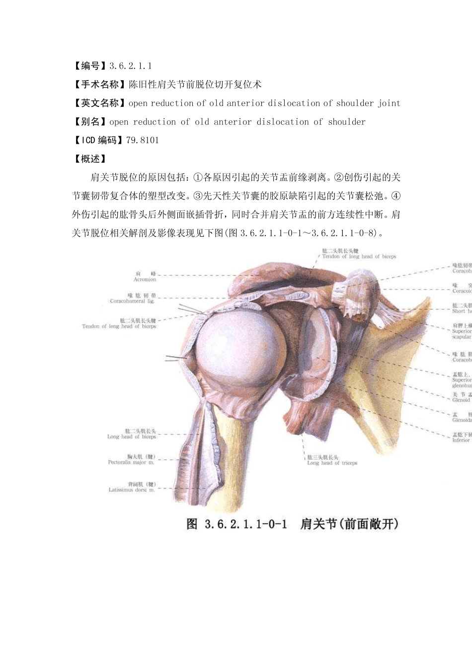 手术_3.6.2.1.1陈旧性肩关节前脱位切开复位术_第1页