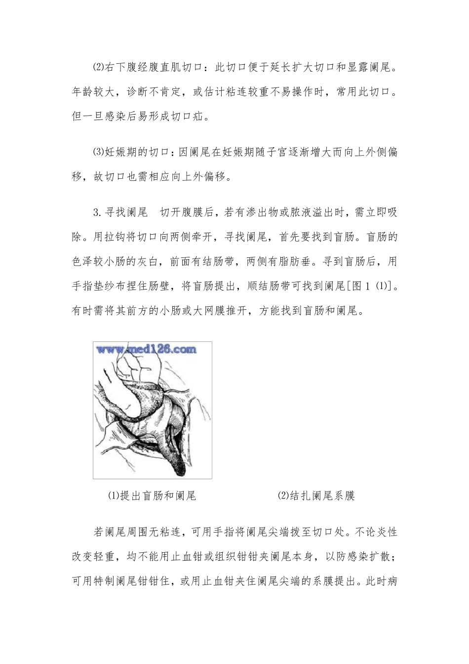手术操作步骤、流程示范：急性阑尾炎手术的操作_第3页