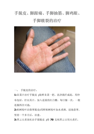 手脱皮难得的偏方