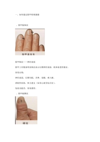 手诊,学习养生知识的伙伴一定要懂