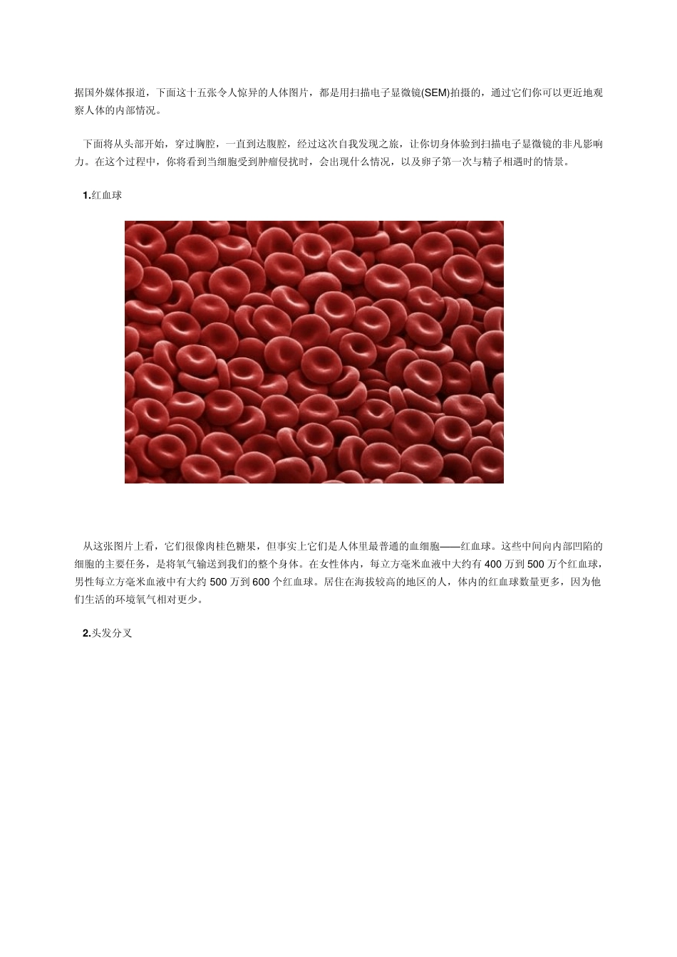 扫描电子显微镜(SEM)拍摄的人体图片_第1页