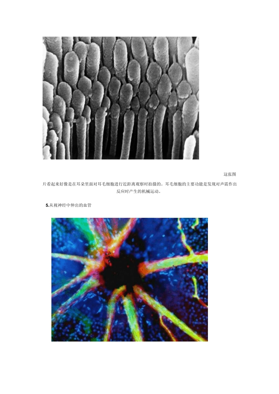 扫描电子显微镜(SEM)拍摄的人体图片_第3页
