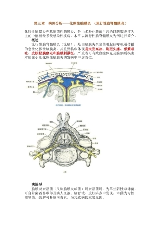2025年病例分析化脓性脑膜炎流行性脑脊髓膜炎执业医师实践技能强化课程讲义