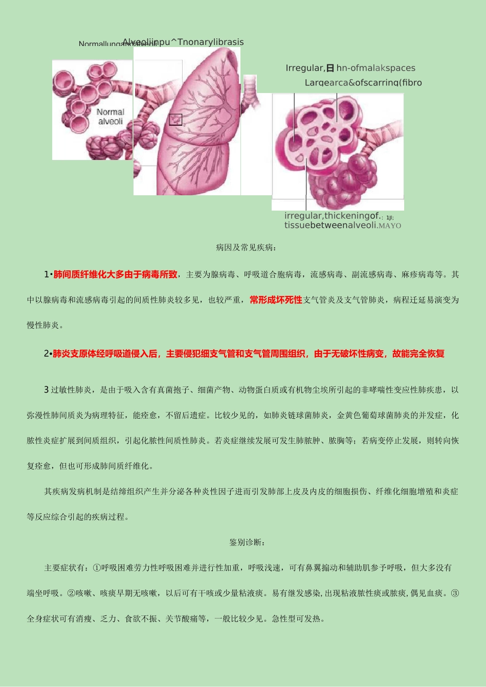 肺间质纤维化_第2页
