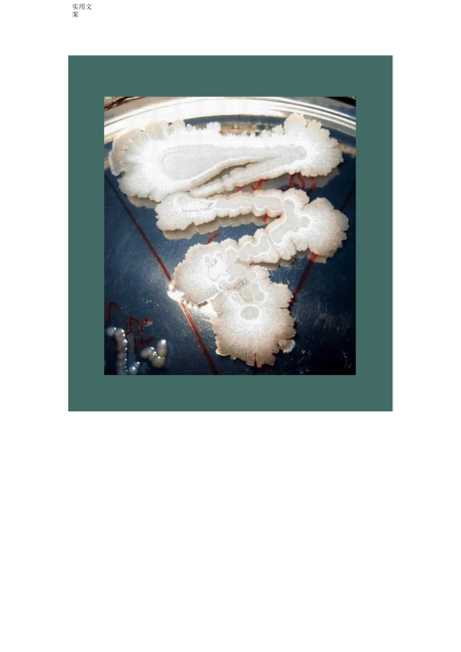 芽孢杆菌形态特征_第1页