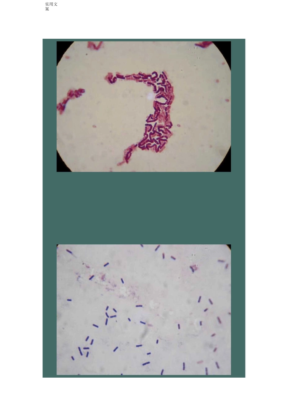 芽孢杆菌形态特征_第2页