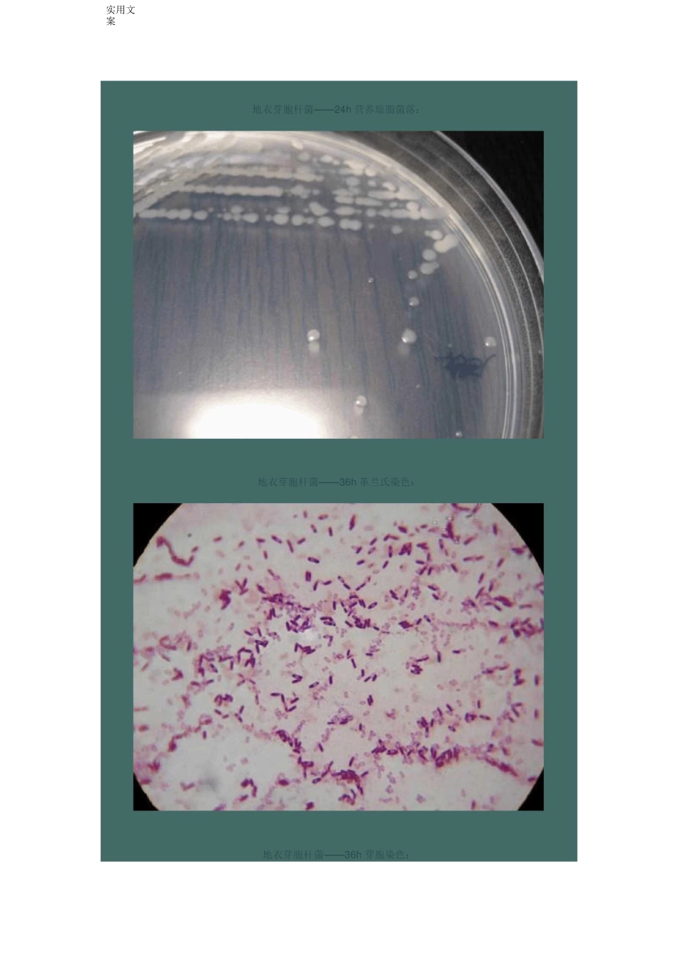 芽孢杆菌形态特征_第3页