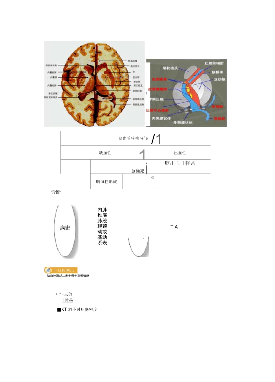 脑血管疾病总结_第3页