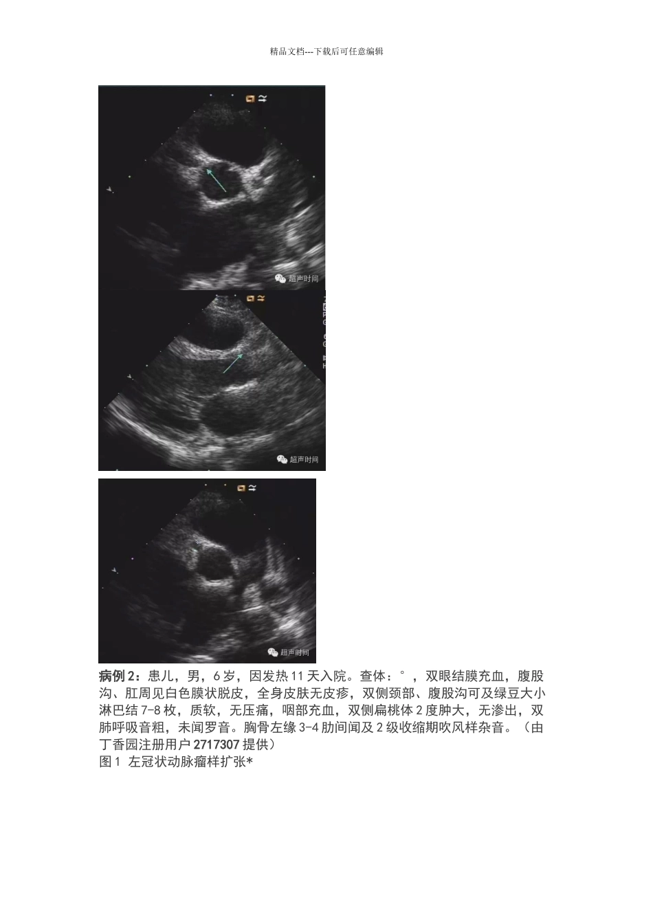 川崎病累计冠脉的超声表现_第3页