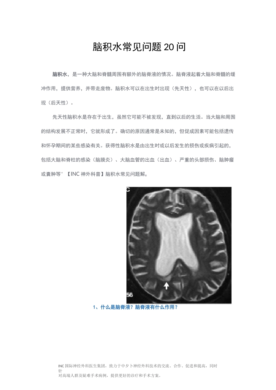 脑积水常见问题20问_第1页