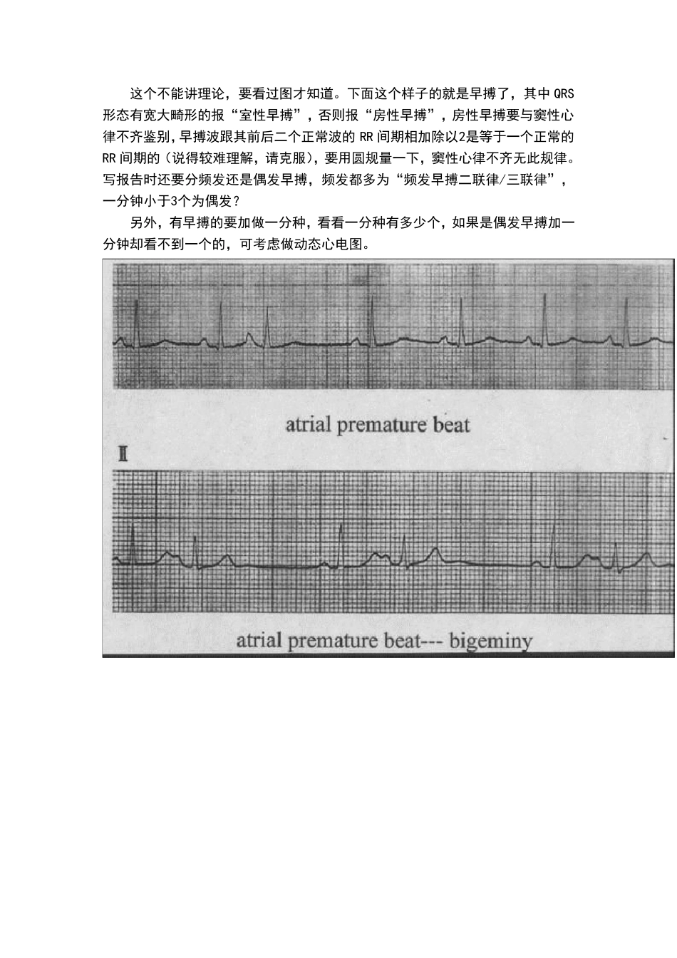 教你如何看懂心电图_第2页