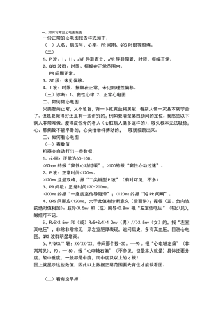 教你如何看懂心电图