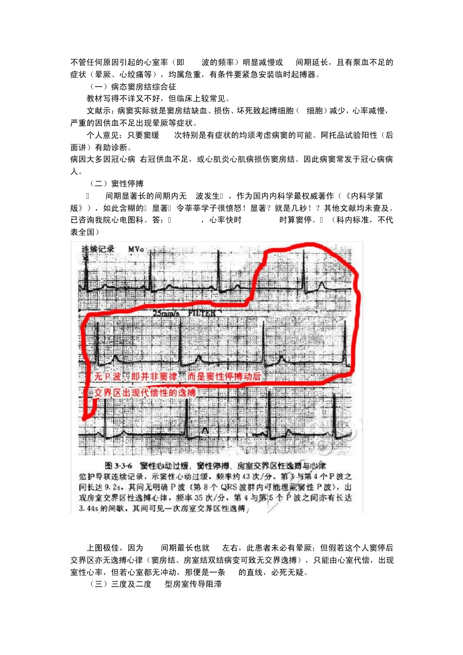 教你快速看懂心电图_第1页