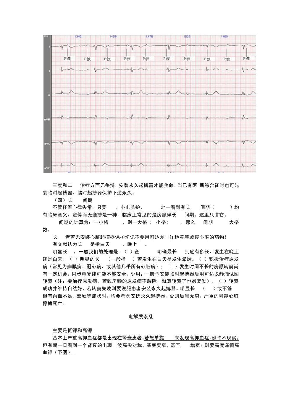 教你快速看懂心电图_第3页