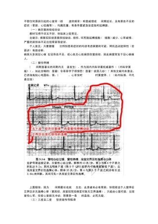 教你快速看懂心电图