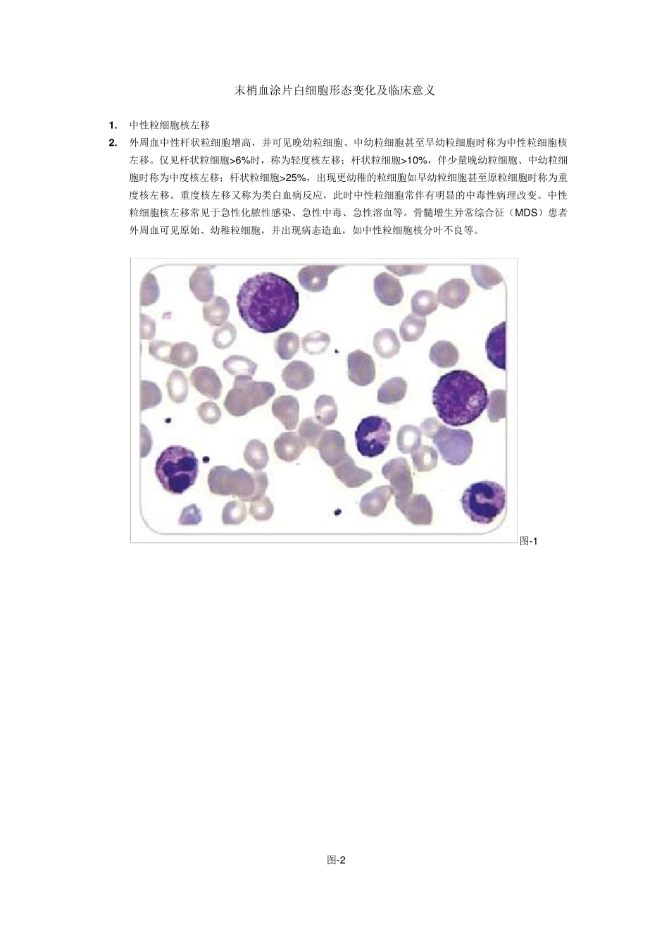 末梢血涂片白细胞形态变化及临床意义_第1页