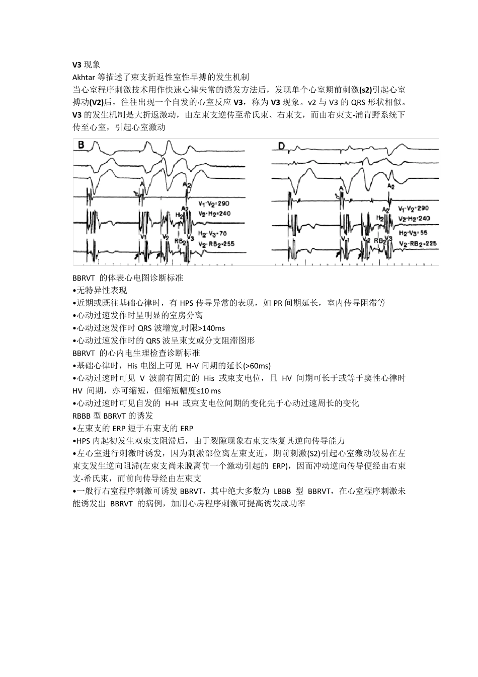 束支折返性室性心动过速_第3页