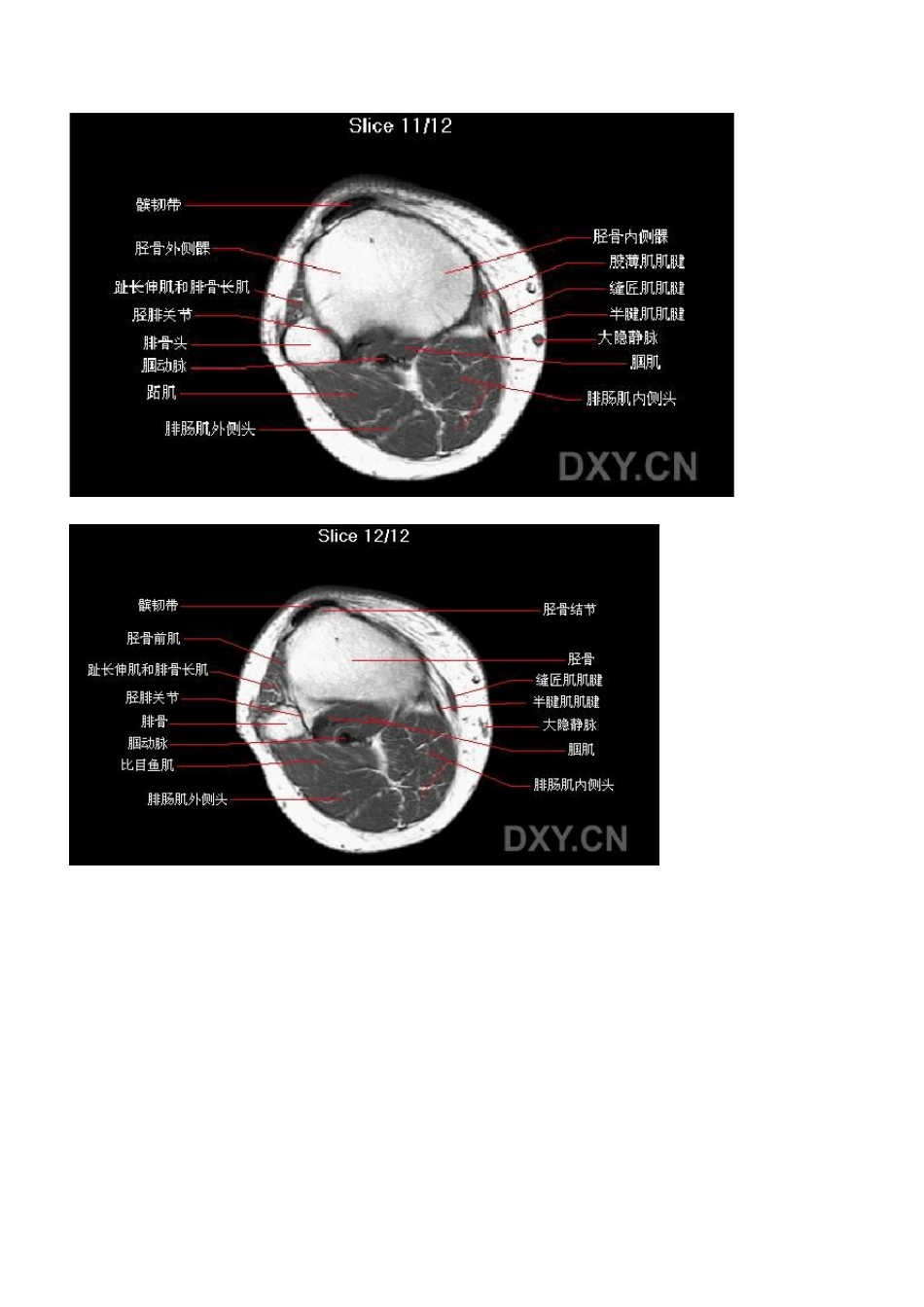 核磁共振MRI的正常影像头颈脊柱膝关节_第2页