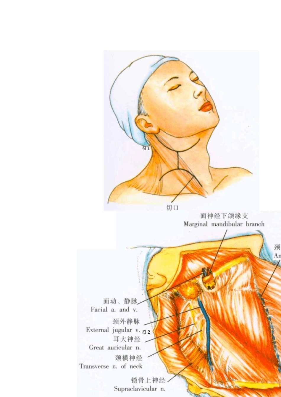 根治性颈淋巴组织清扫术_第3页