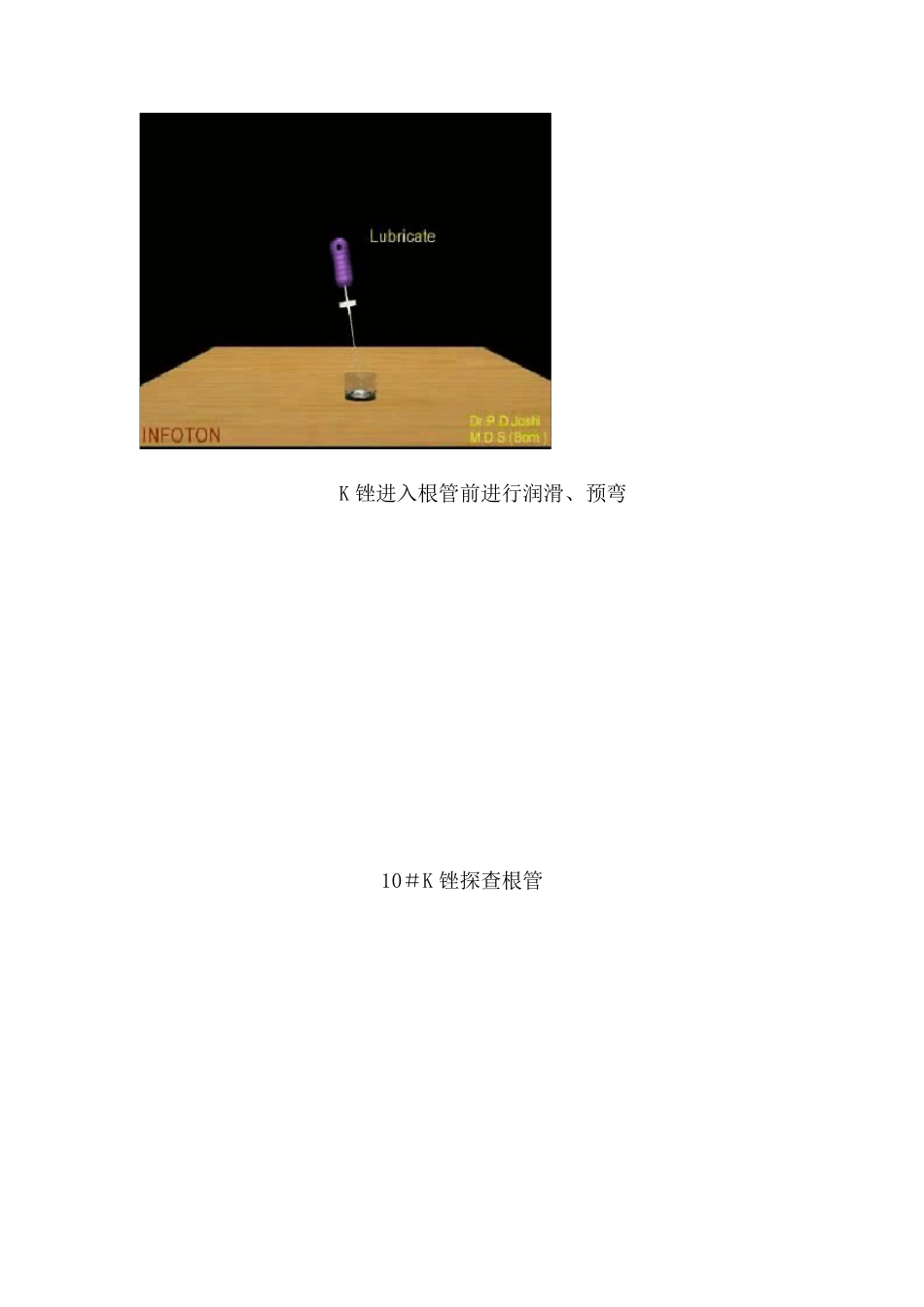 根管预备操作流程_第2页