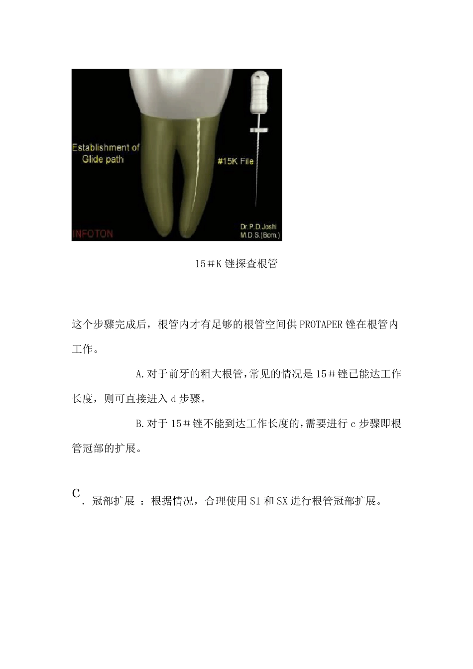 根管预备操作流程_第3页