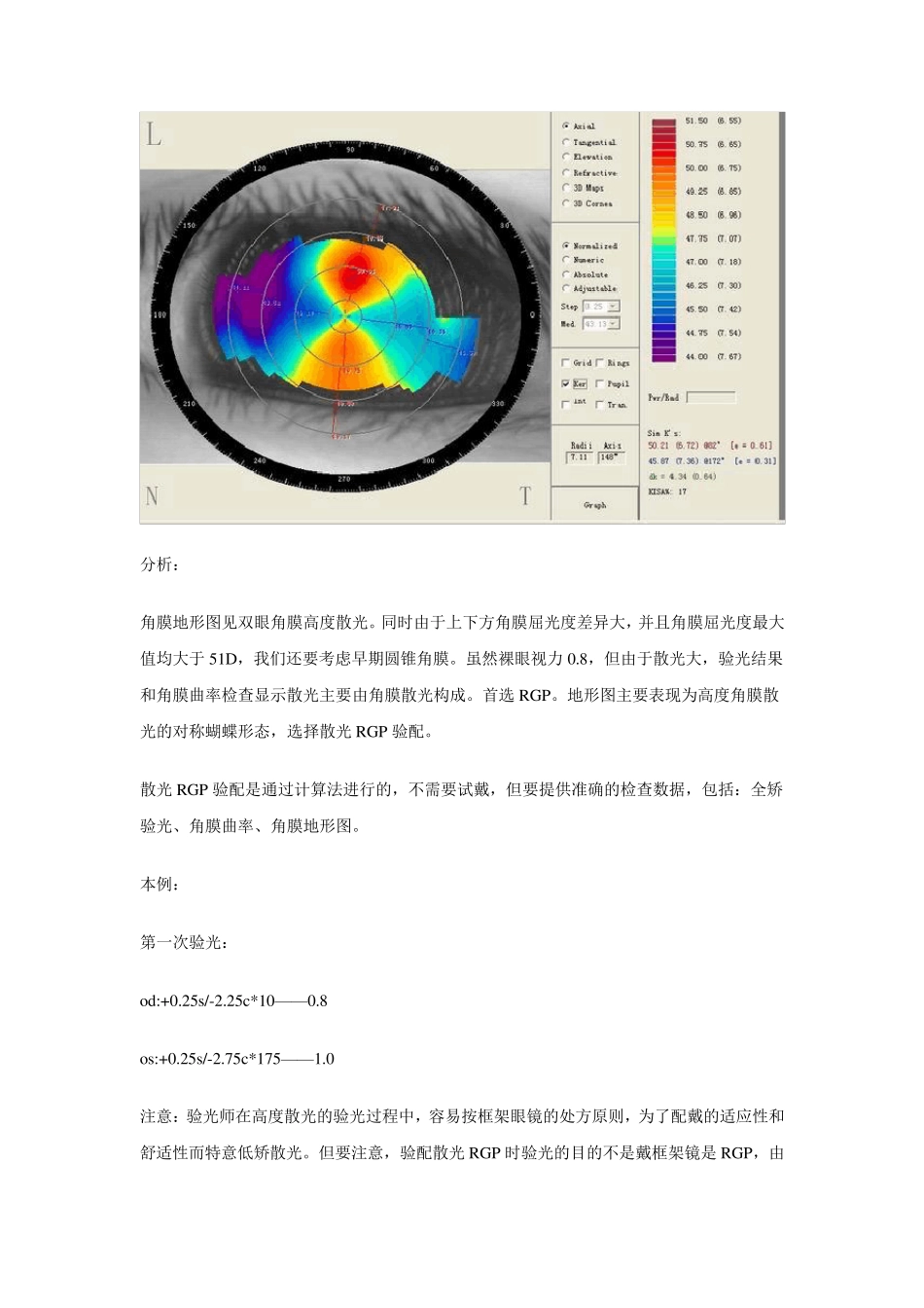 案例说明散光RGP验配要点_第2页
