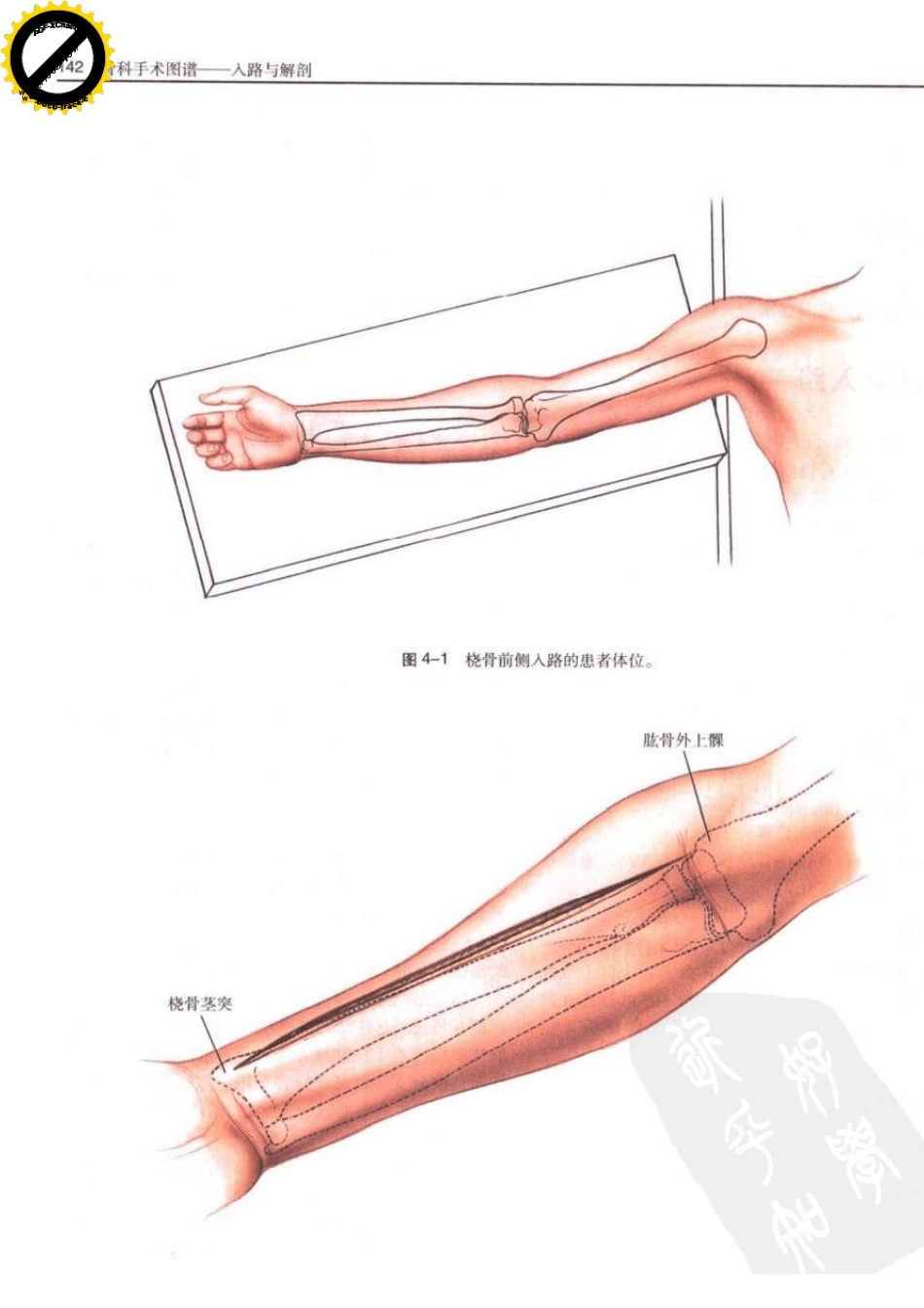桡骨前外侧入路,Henry入路骨科手术图谱入路与解剖_第2页
