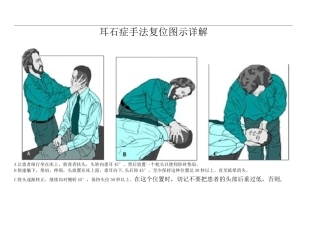 耳石症手法复位图示详解