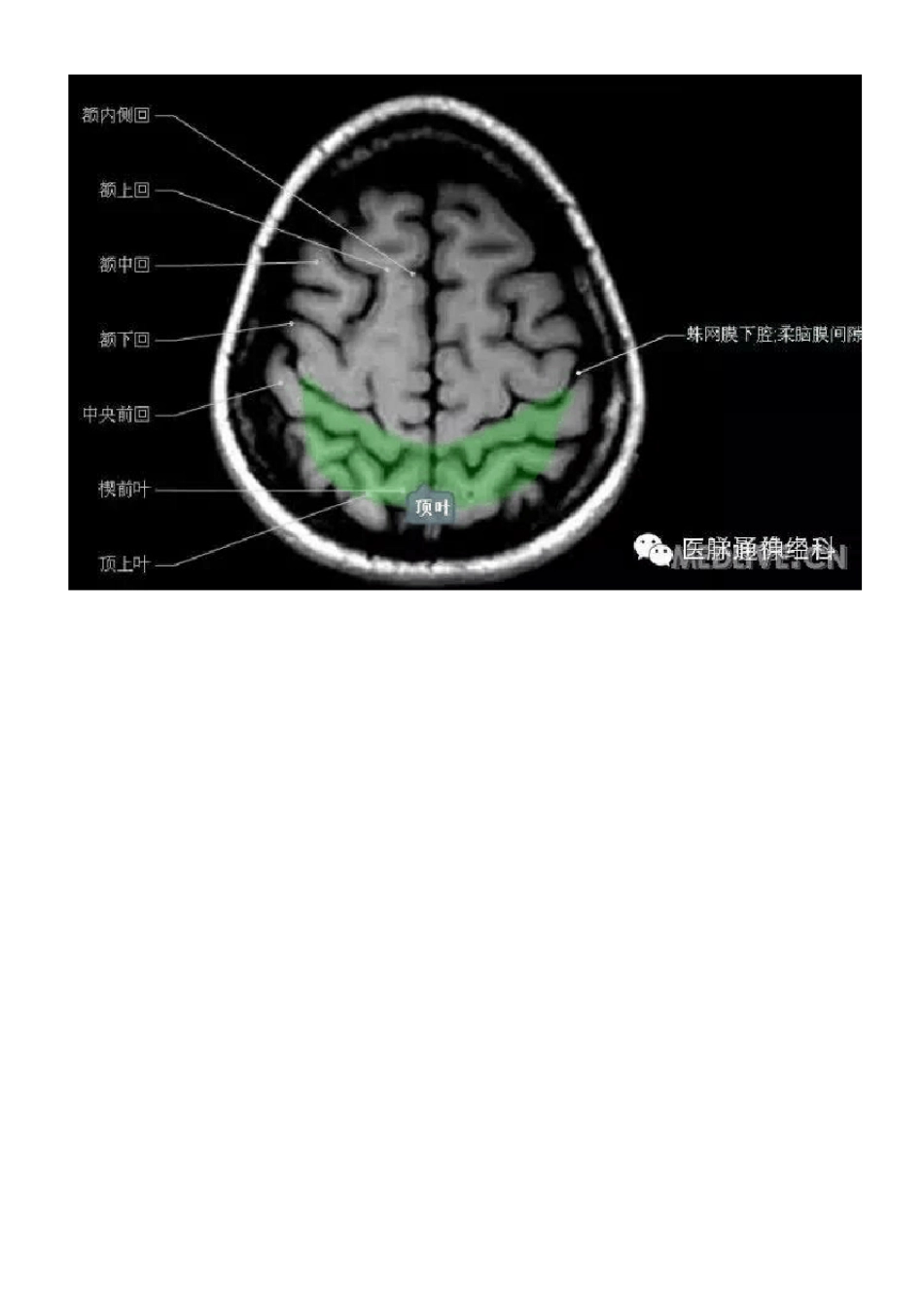 正常颅脑磁共振图示_第2页