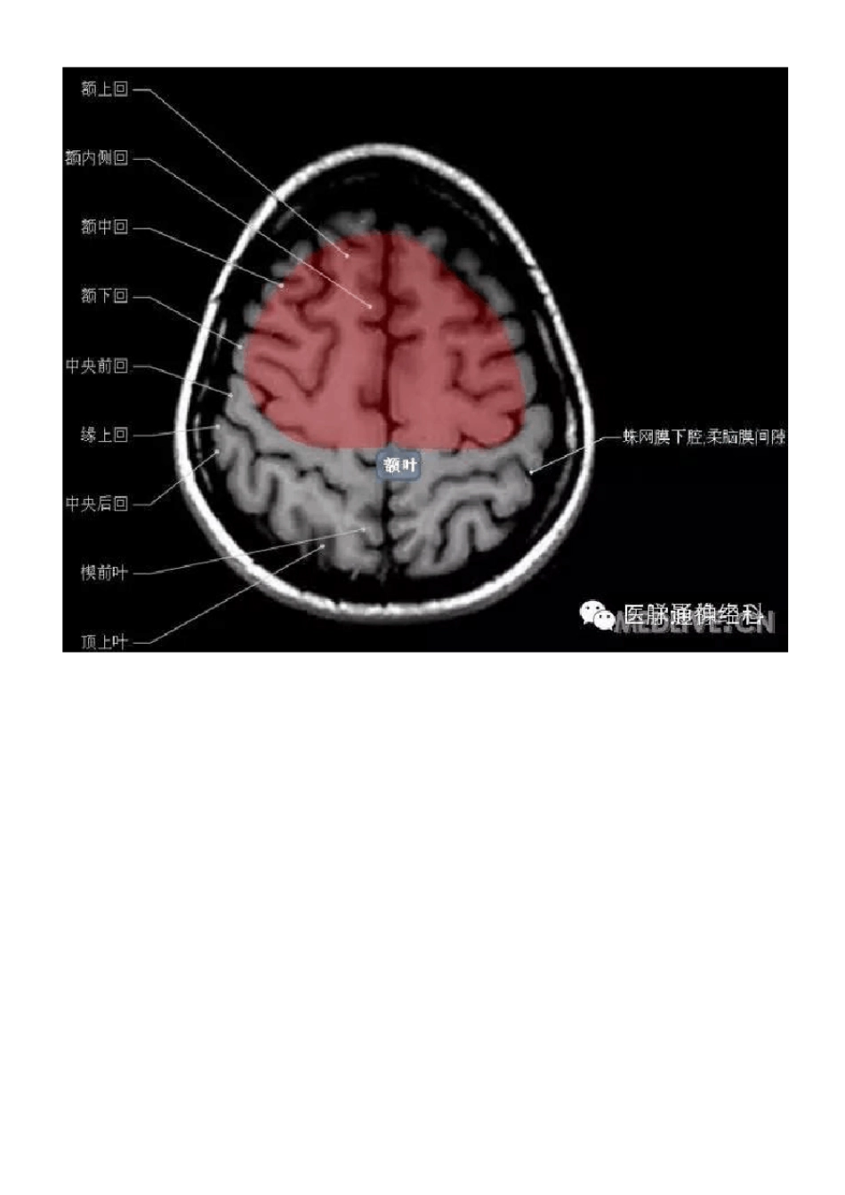 正常颅脑磁共振图示_第3页