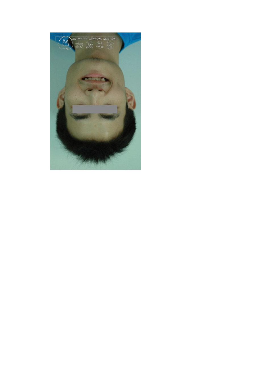 正畸教科书上的经典病例_第2页