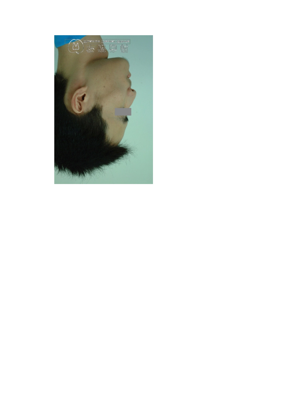 正畸教科书上的经典病例_第3页