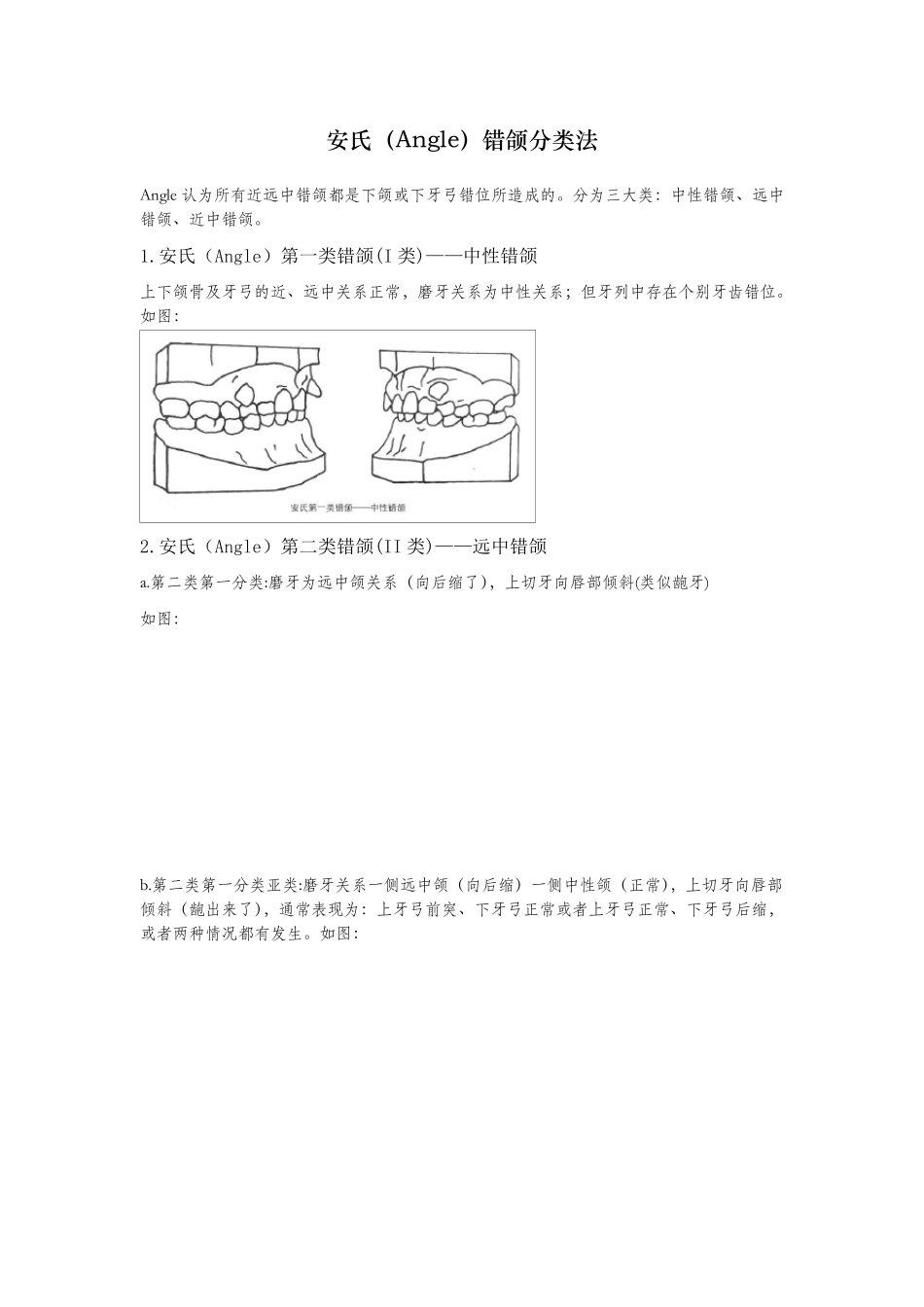 正畸错颌畸形分类图示例_第1页