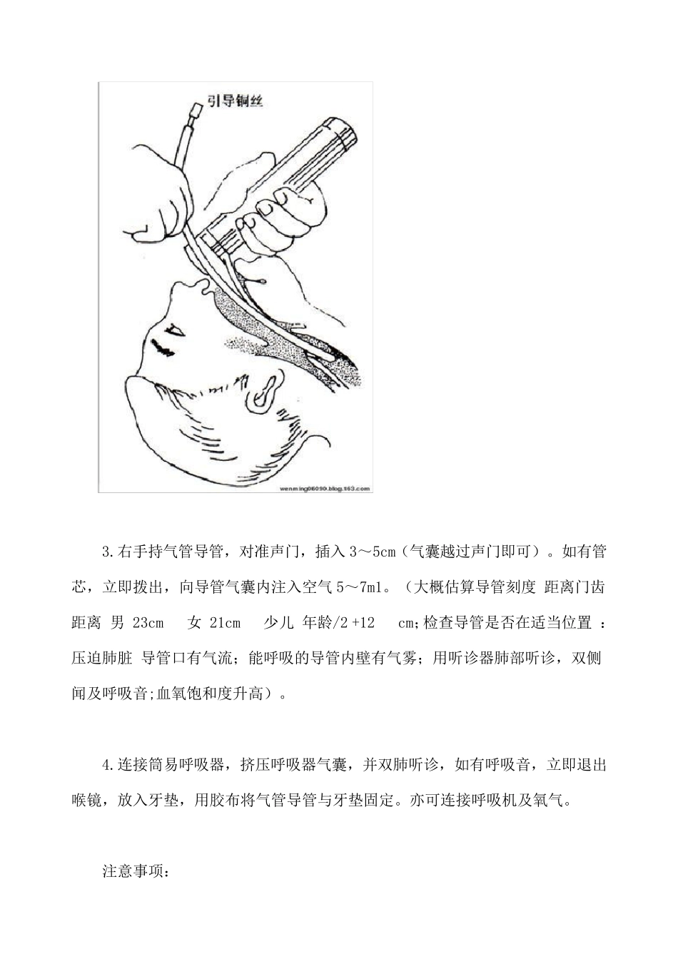 气管插管大全_第2页