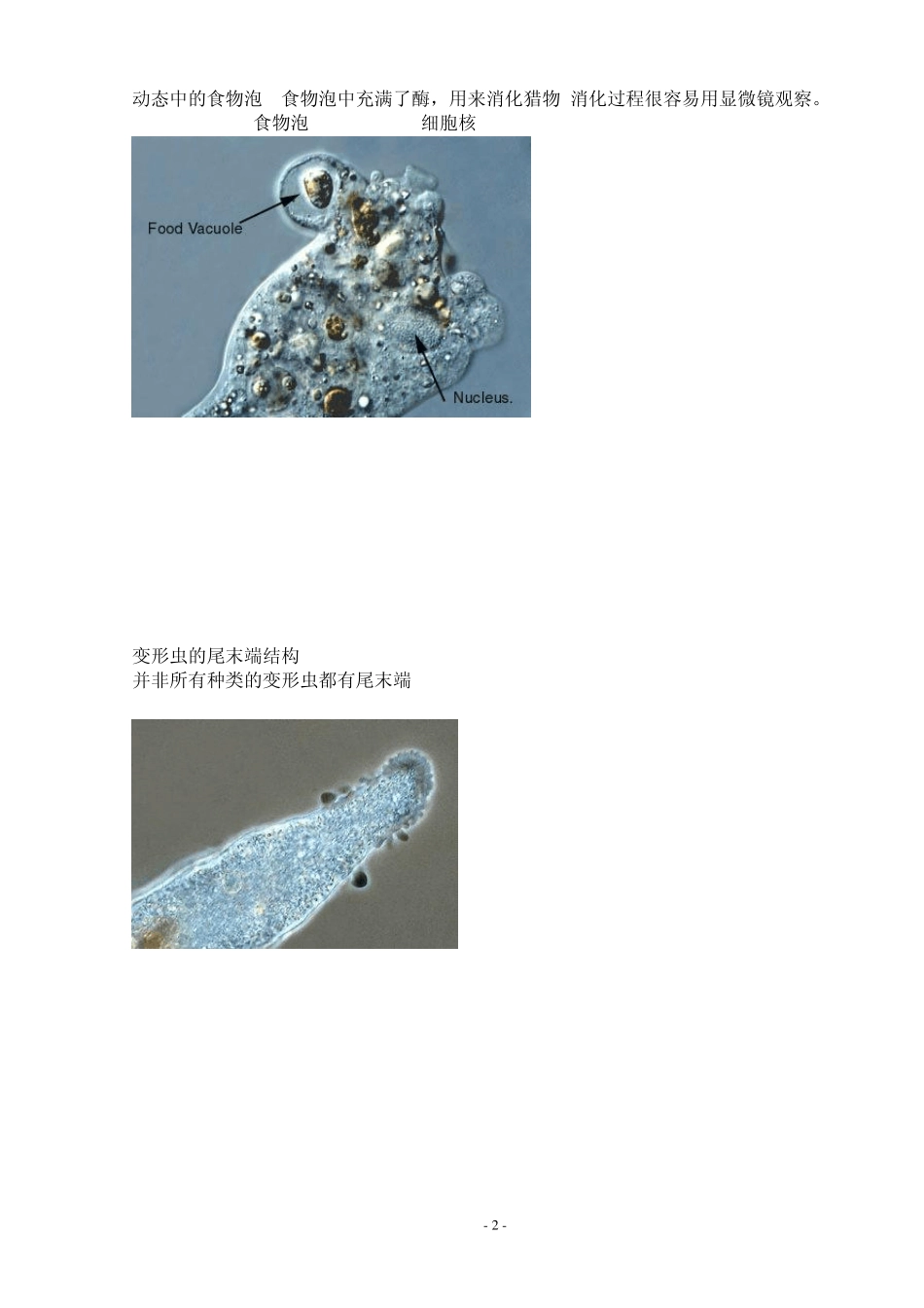 污水处理厂活性污泥微生物照片_第2页