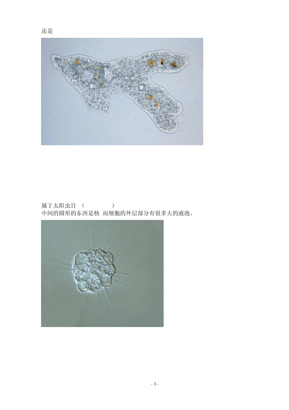 污水处理厂活性污泥微生物照片_第3页