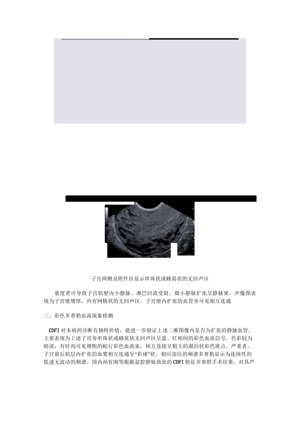 盆腔静脉曲张症_第3页