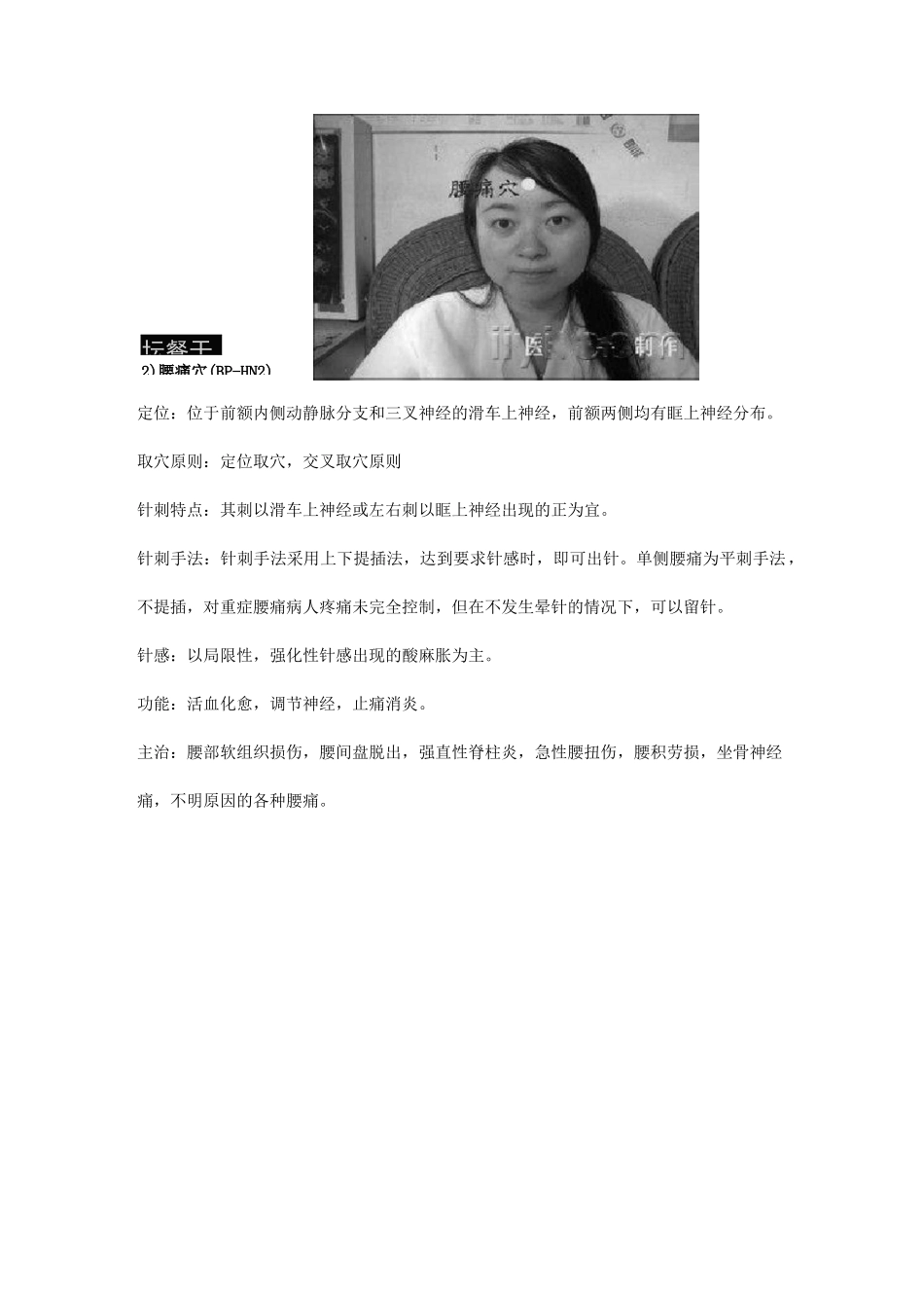 平衡针疗法附穴位图(1)剖析_第2页