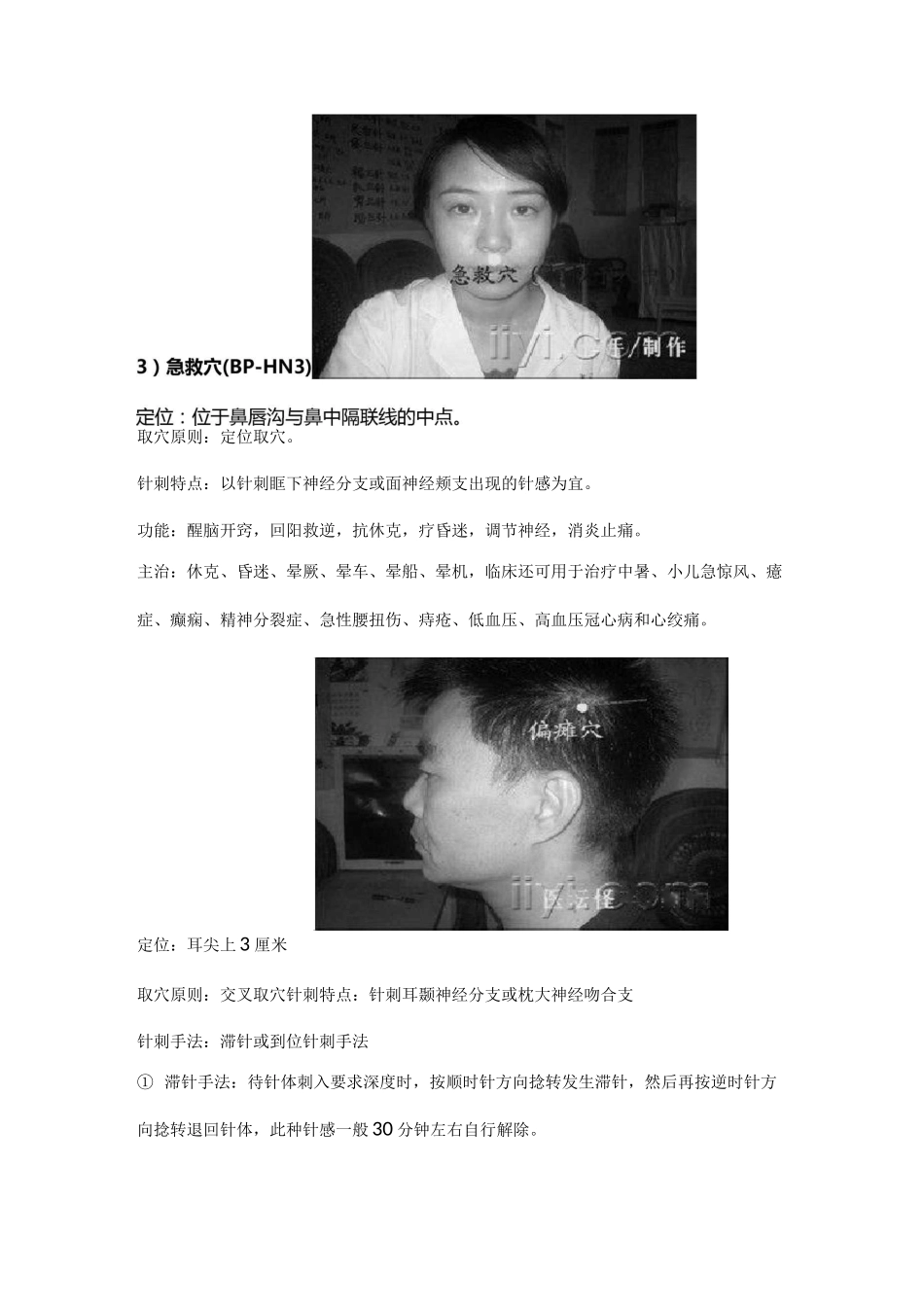 平衡针疗法附穴位图(1)剖析_第3页