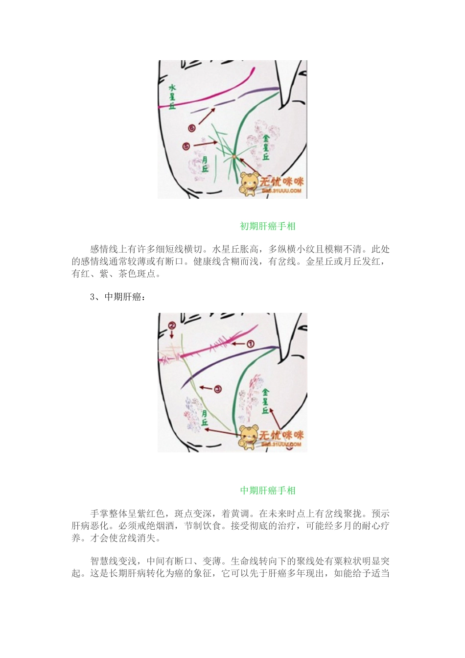 2022年医学专题—做自己的医生24种手相揭示身心健康问题_第2页