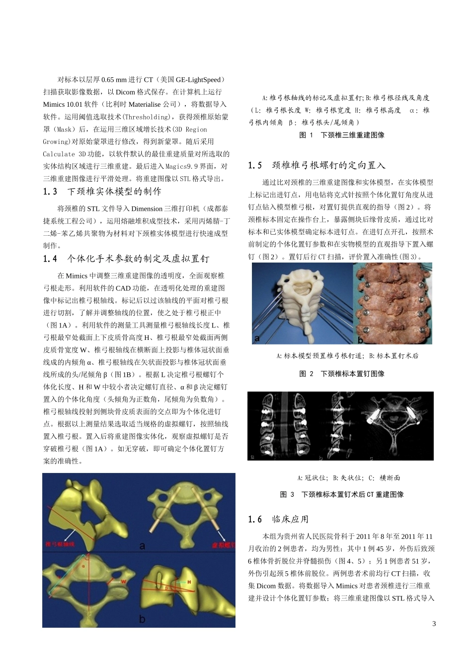 Mimics及脊柱模型用于下颈椎椎弓根个体化置钉的应用研究_第3页