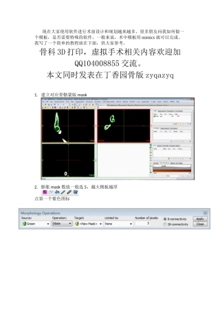 mimics手术导板制作-简单易行
