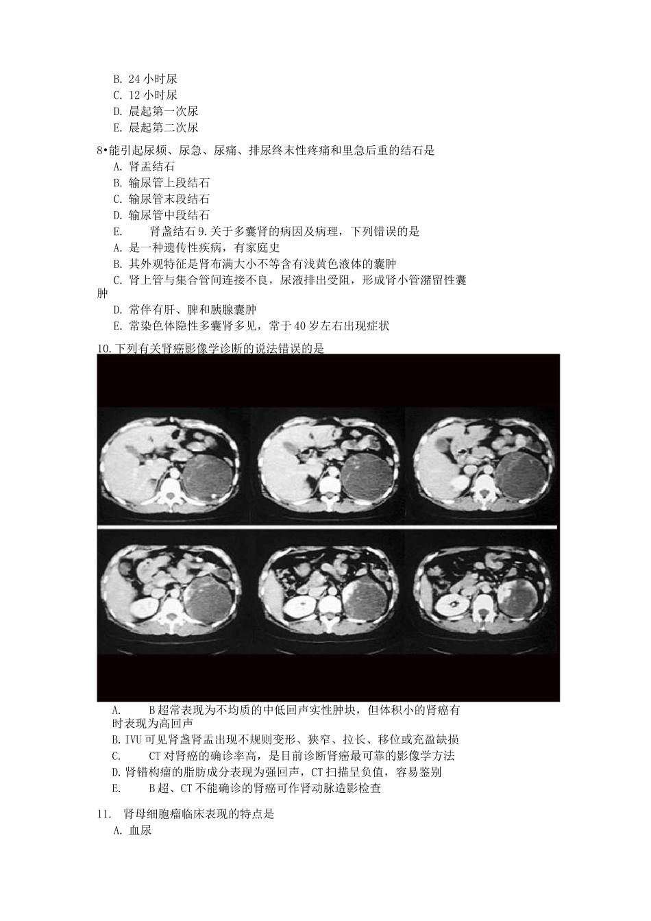 医科大学-外科学泌尿期末试卷及答案一(A)_第2页