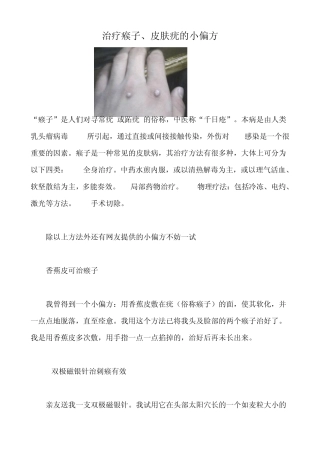 治疗瘊子皮肤疣的小偏方