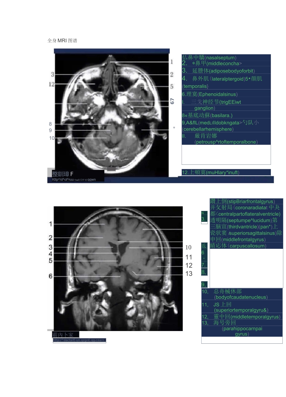 全身MRI图谱_第1页