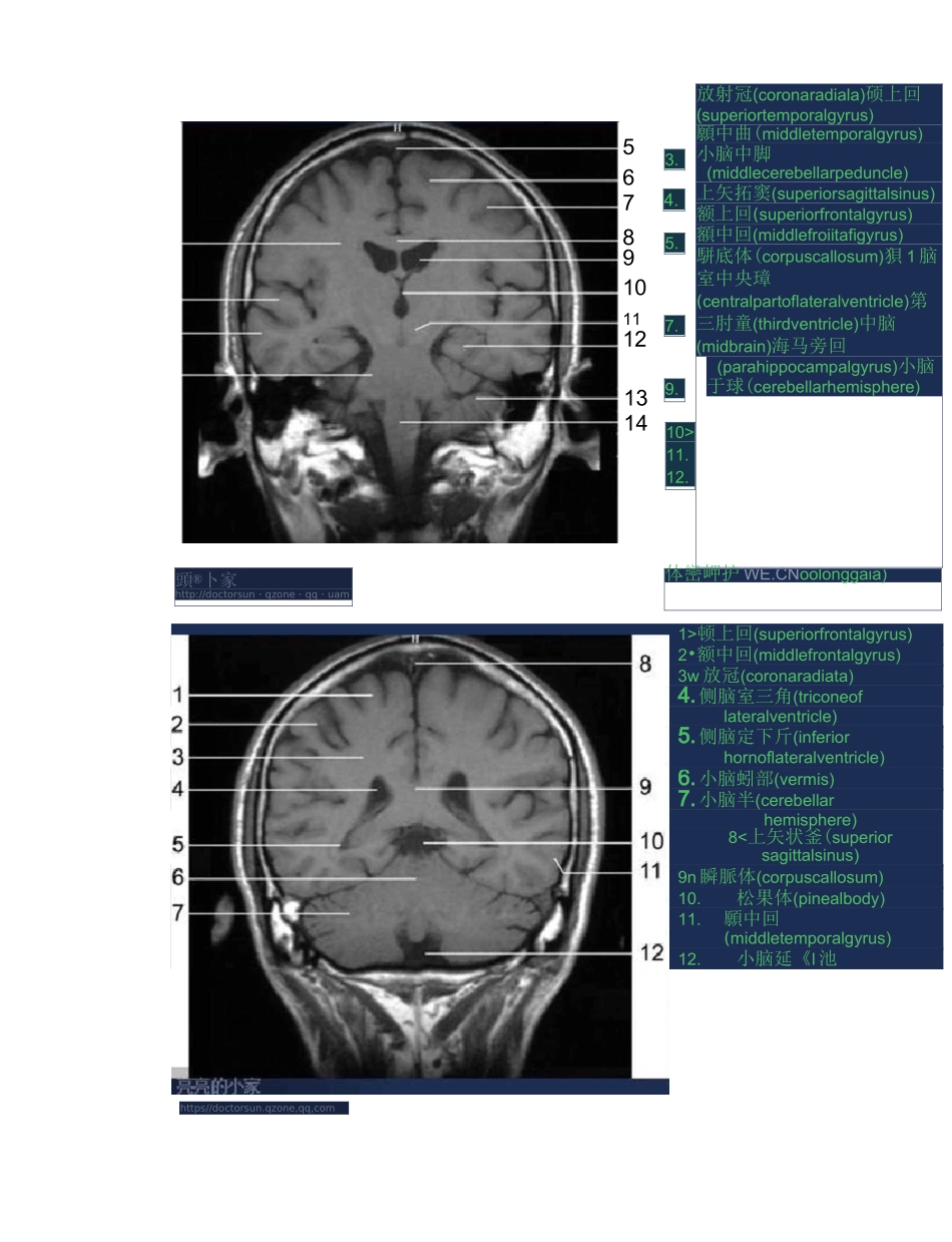 全身MRI图谱_第2页
