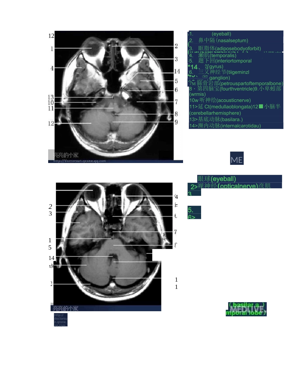 全身MRI图谱_第3页