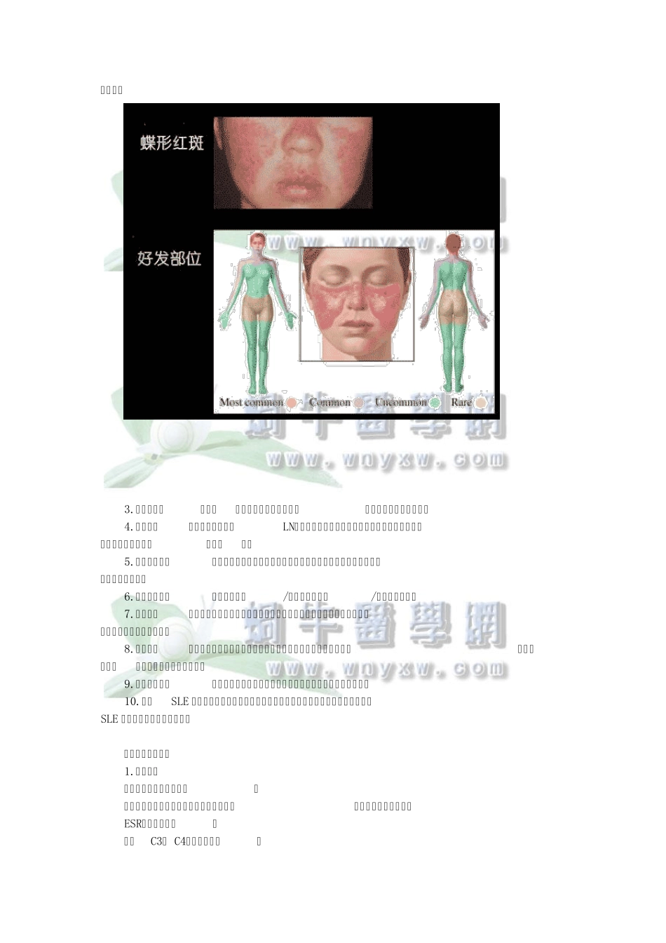 病例分析——系统性红斑狼疮_第2页