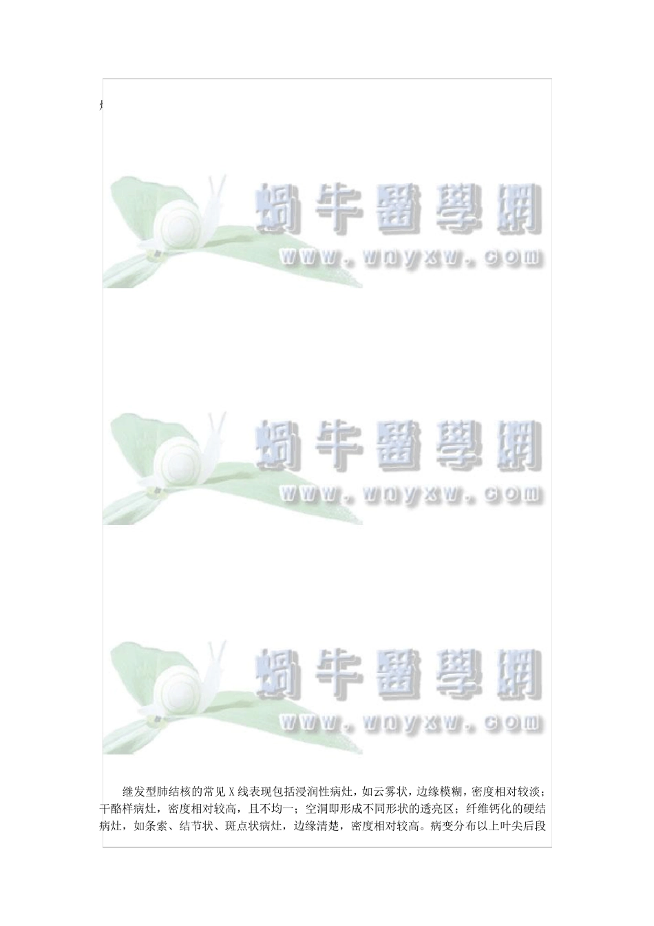 病例分析——肺结核_第2页